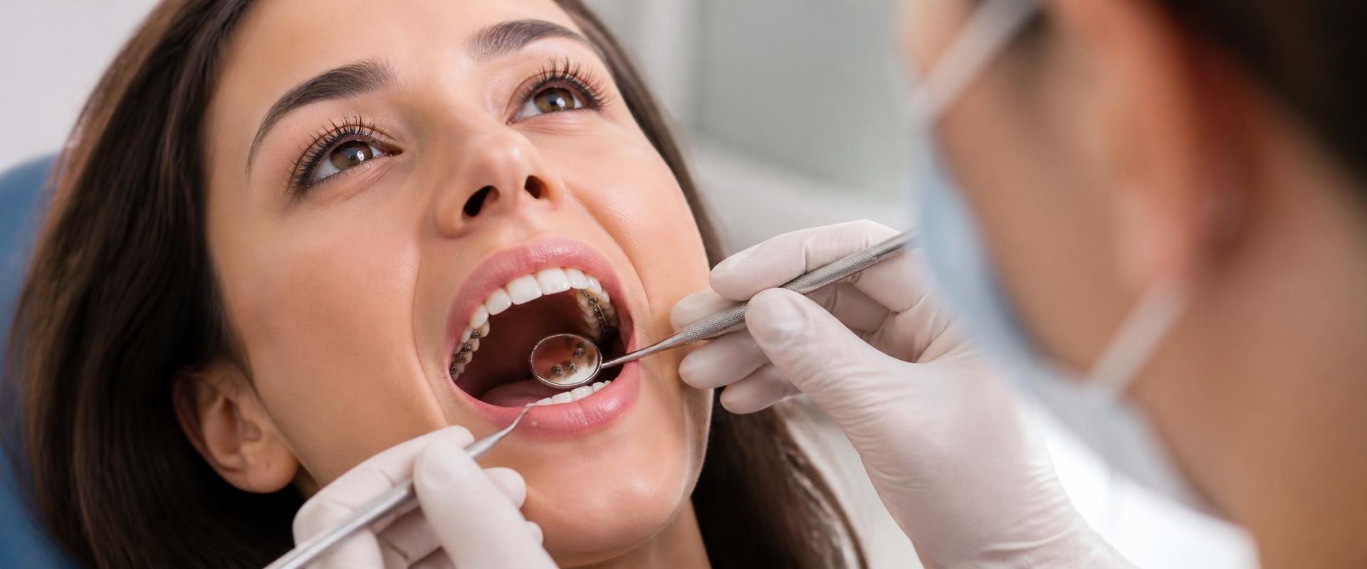 Understanding Lingual Braces: The Hidden Orthodontic Solution