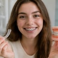 Comparing Traditional Braces and Invisalign for Orthodontic Treatment