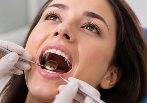 Understanding Lingual Braces: The Hidden Orthodontic Solution